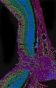 In cross-section, the optic nerve and retina funnel (left to right) information to the brain. The optic nerve (the purple stem of the funnel) collects information from the retina (the mouth of the funnel). 