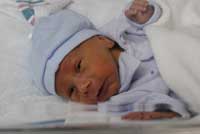 A premature baby