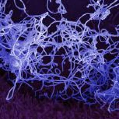 Microscopy photo of the Ebola virus.