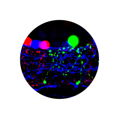 microscopic photo 
