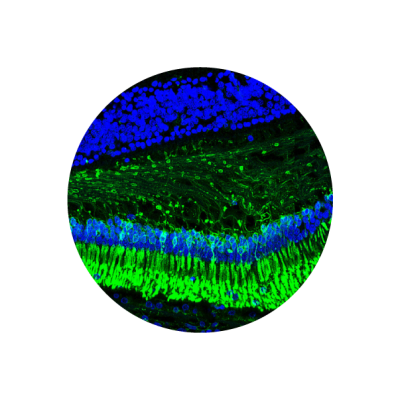 microscopic photo 