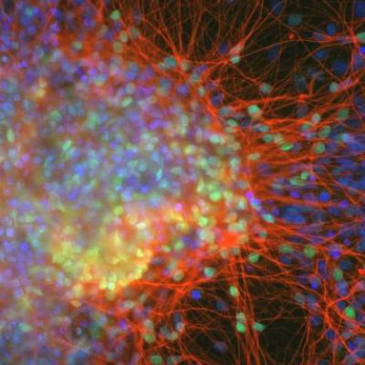 Image of Cortical neurons