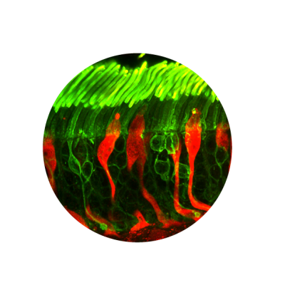 Photo of retinal cell