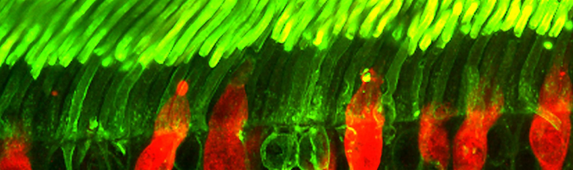 microscopic image of a retinal cell