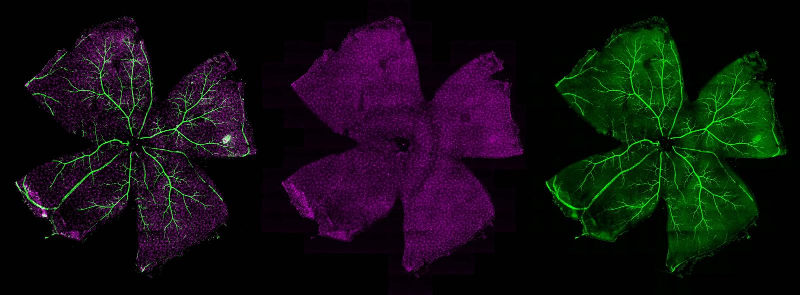 A confocal microscope image of a flatmounted mouse retina labeled by ganglion cells (fuschia) and vasculature (green).