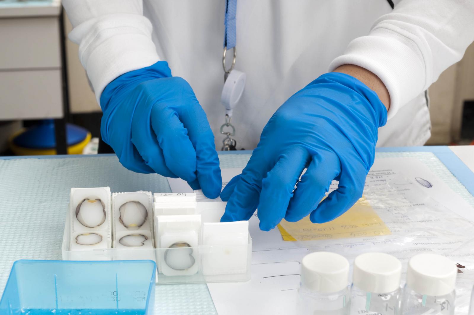 Researcher wearing blue latex gloves and handling eye specimens