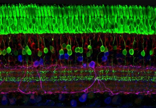 Microscopic image of ground squirrel retina and cone receptors in the top layer