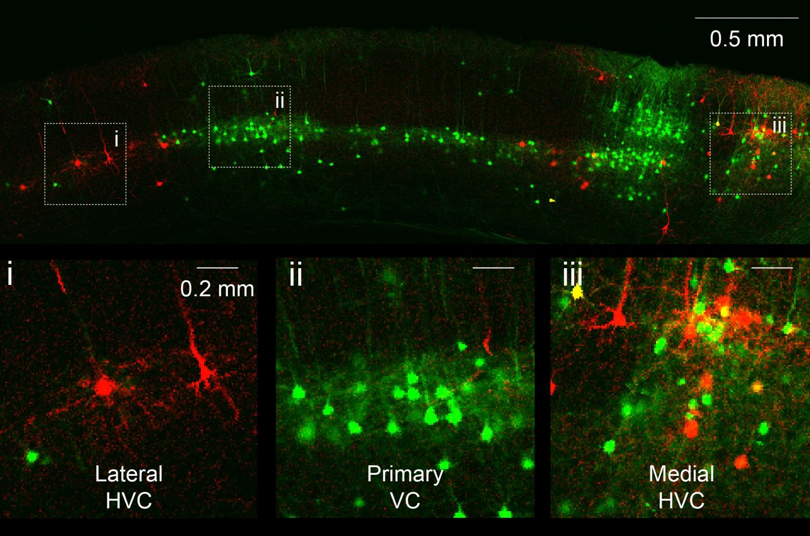 Microscopy images of neurons in mouse brain colored red and green