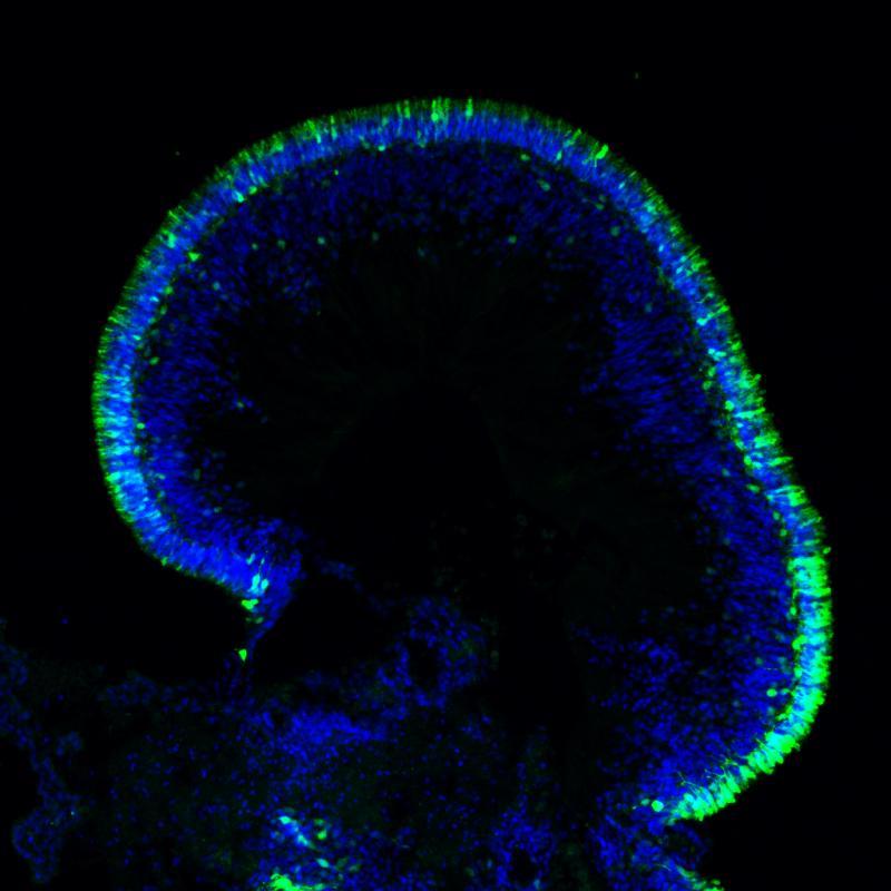 Image of a Retinal Organoid