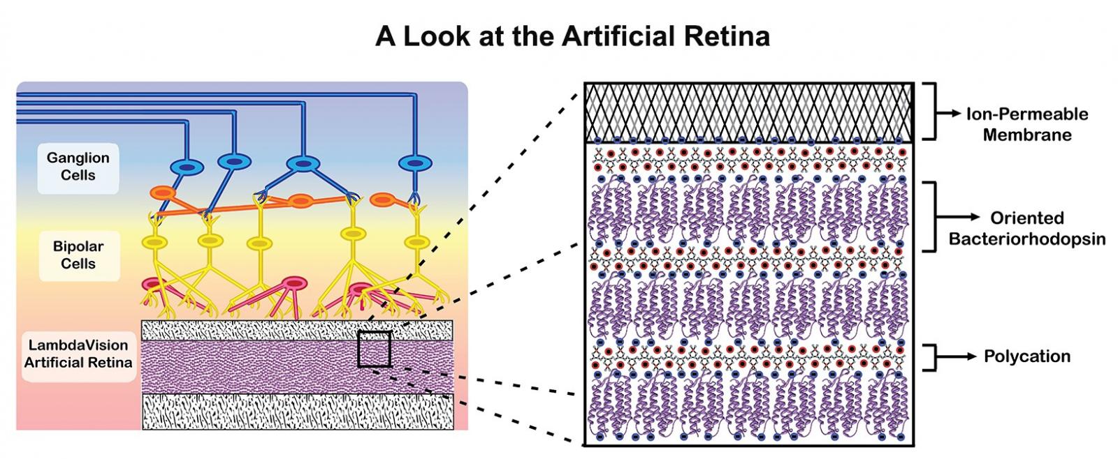 Ganglion cells, bipolar cells, LambdaVision artificial retina, ion-permeable membrane, oriented bacteriorhodopsin, polycation