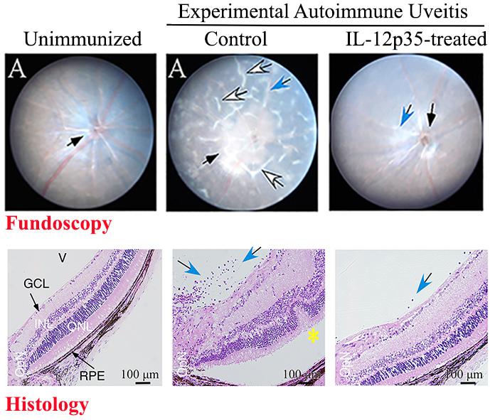 experimental autoimmune uveitis