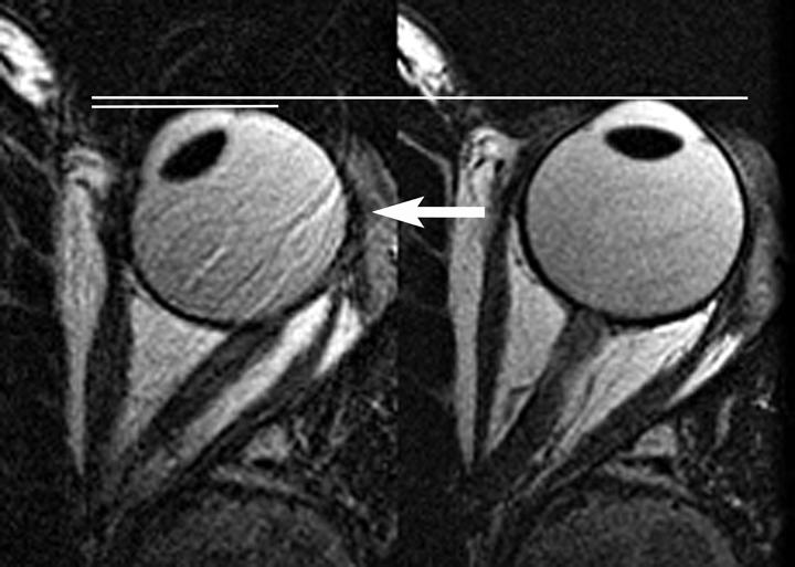 MRI image