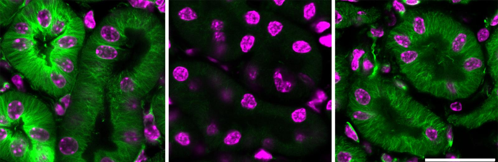 Three side-by-side images showing bright green cells on left and right panels, and only pale green cells in center.