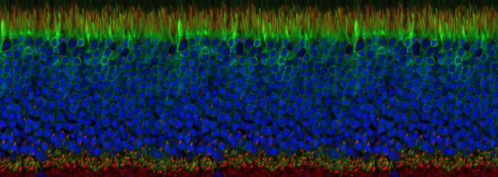 Retinal cross section with photoreceptors and nuclei stained