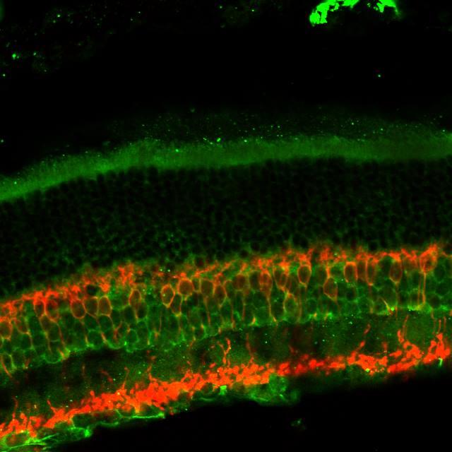 Rod Bipolar Cells in the Retinal Circuitry