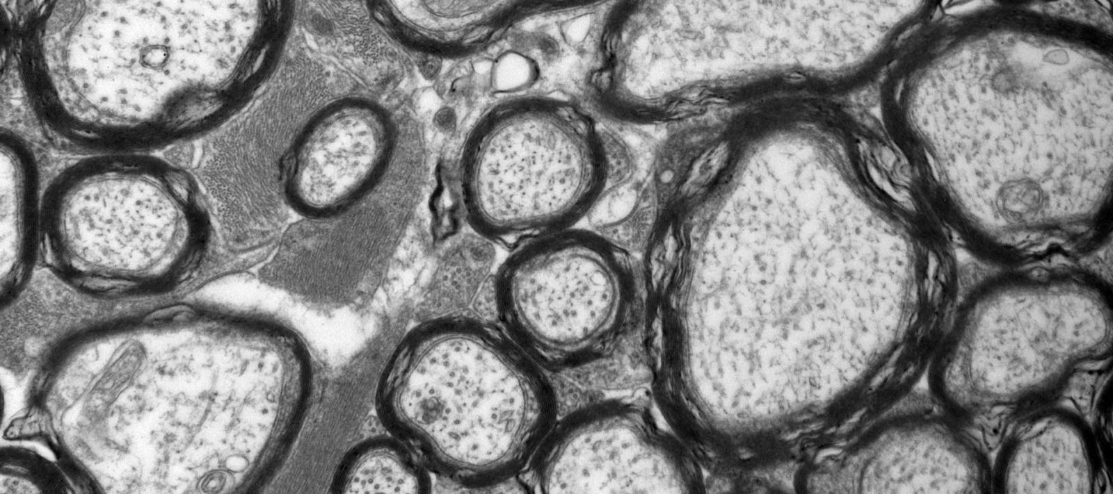 Transmission electron microscopy of a section of mouse optic nerve taken at 20,000X magnification. Photo by Mones Abu-Asab, PhD