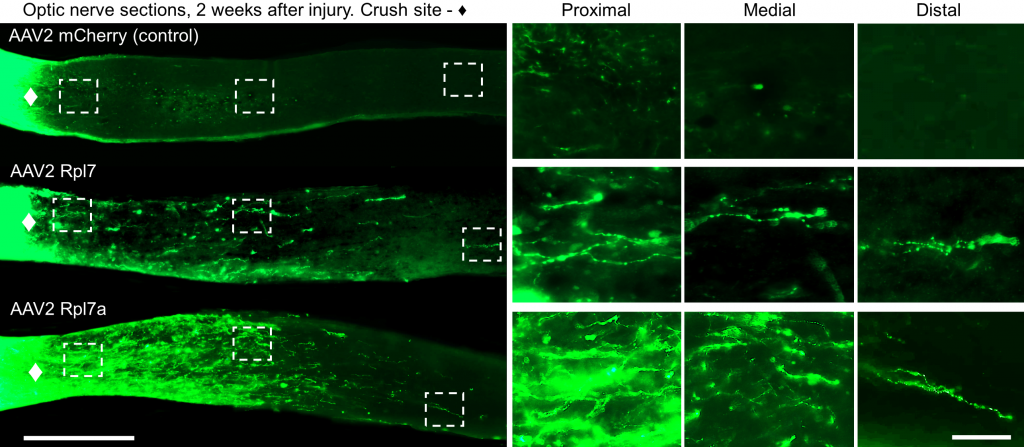 Axons regrowing