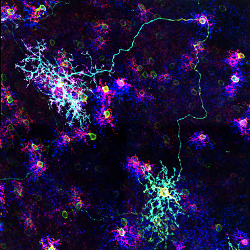 Focus on Fellows winner image 2024