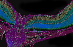 Cross section of retina and optic nerve