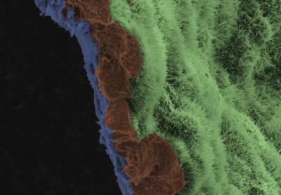 A scanning electron micrograph image shows a polarized RPE monolayer on a biodegradable scaffold