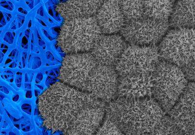 Image of scanning electron micrograph