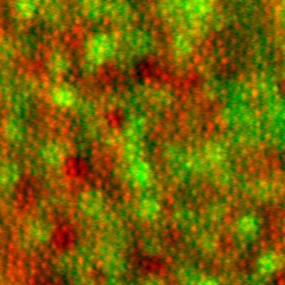 Cone photoreceptor neurons and retinal pigment epithelial cells