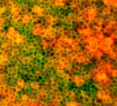 Retinal pigment epithelial cells imaged  using adaptive optics