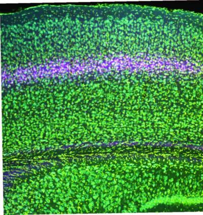 A section of cortex with colorfully labeled layers. Layer 4 stands out in a pinkish hue