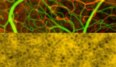 neuron vessels