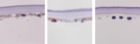 Corneal sections from a person with Fuchs dystrophy (left), normal with staining (center), and normal no staining (right)