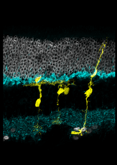 Micrograph of retina