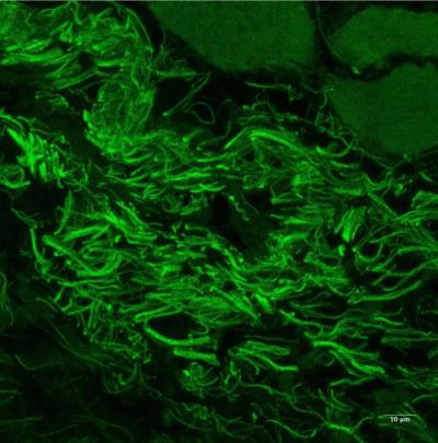 Micrograph of surface of the eye showing green bacteria