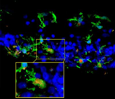 Microglia in retinal sections of a patient with retinitis pigmentosa 