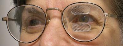 Man wearing glasses with prisms above and below one eye