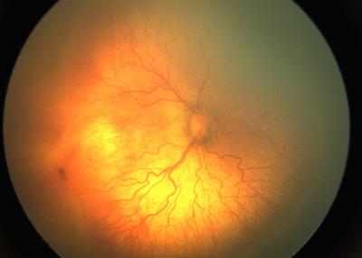 A fundus image