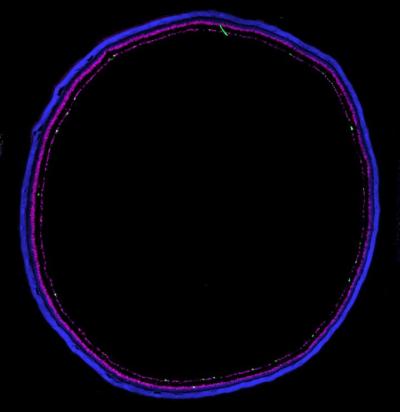 Purple, pink, white rings showing fluorescence from retina section