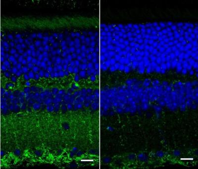 Fluorescent images of mouse retinal layers