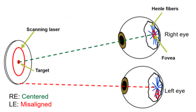 Schematic showing blinq™ process