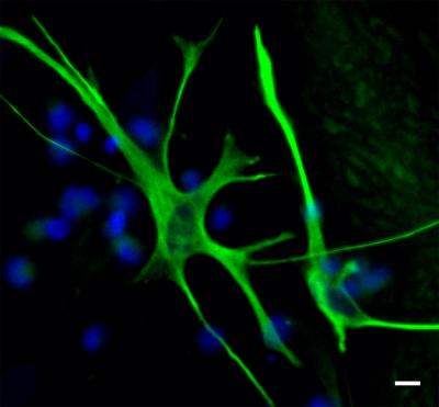 Fluorescent green cell with long projections