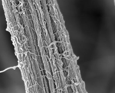 Zonular microfibrils.