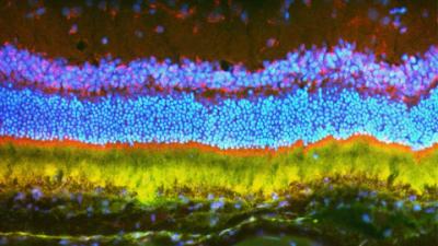 Multicolor image of retina in cross-section