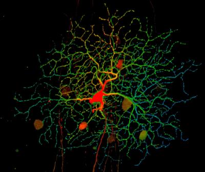 Retinal ganglion cell with a red cell body and green axons spread out over a large area