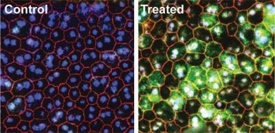 Image of mouse retinas with and without gene therapy treatment