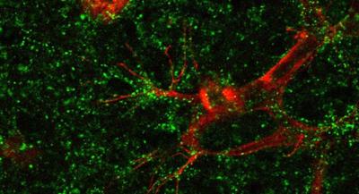Microscopy image of retina with wide red vessels and green dots