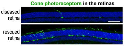 Images of retina with single photoreceptor versus retina with many photoreceptors