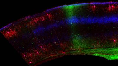 Microscopy image showing cells in red and green