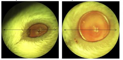 An abnormally small mouse eye, versus a normal-sized mouse eye