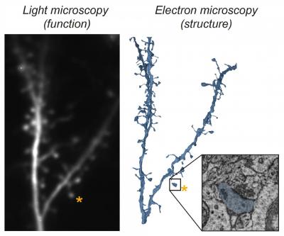 Light and electron micron microscopy representations of a neuron showing synapses