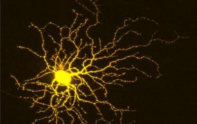 A yellow cell with many dendrites