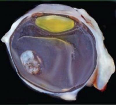 Slice through a 3D eye